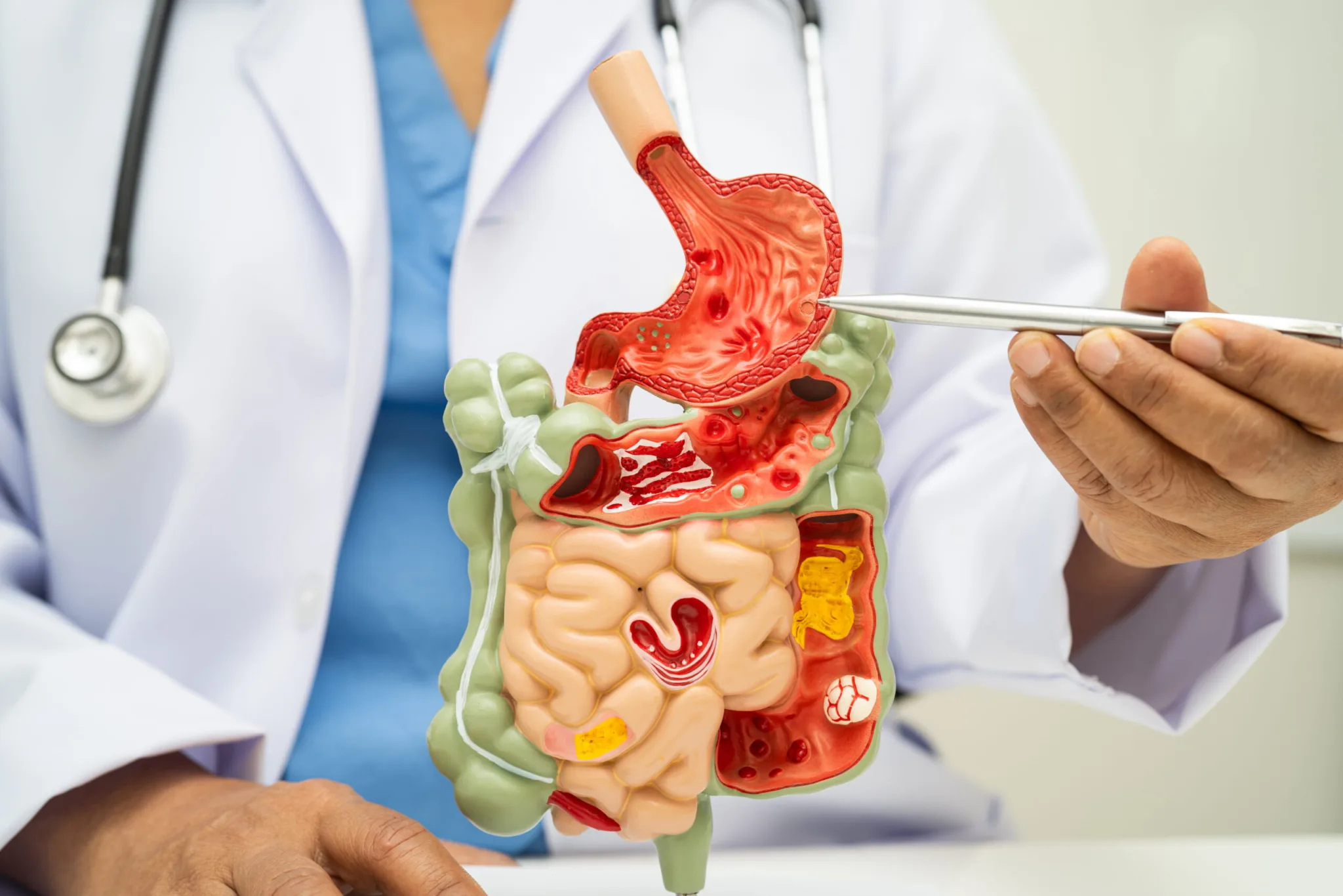 best gastro doctor in dubai