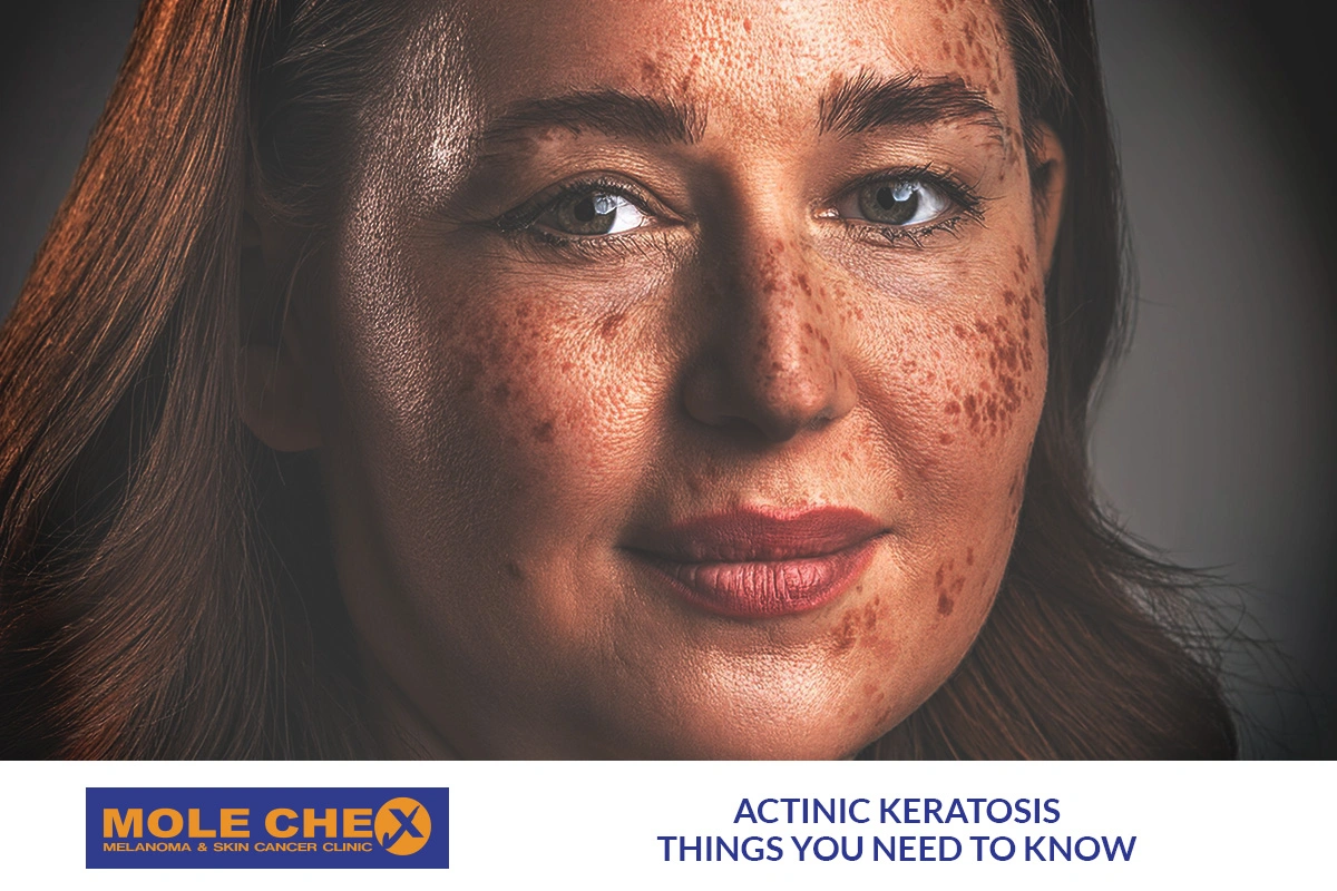 Actinic Keratosis Specialists examining suspicious skin spots for early diagnosis and treatment